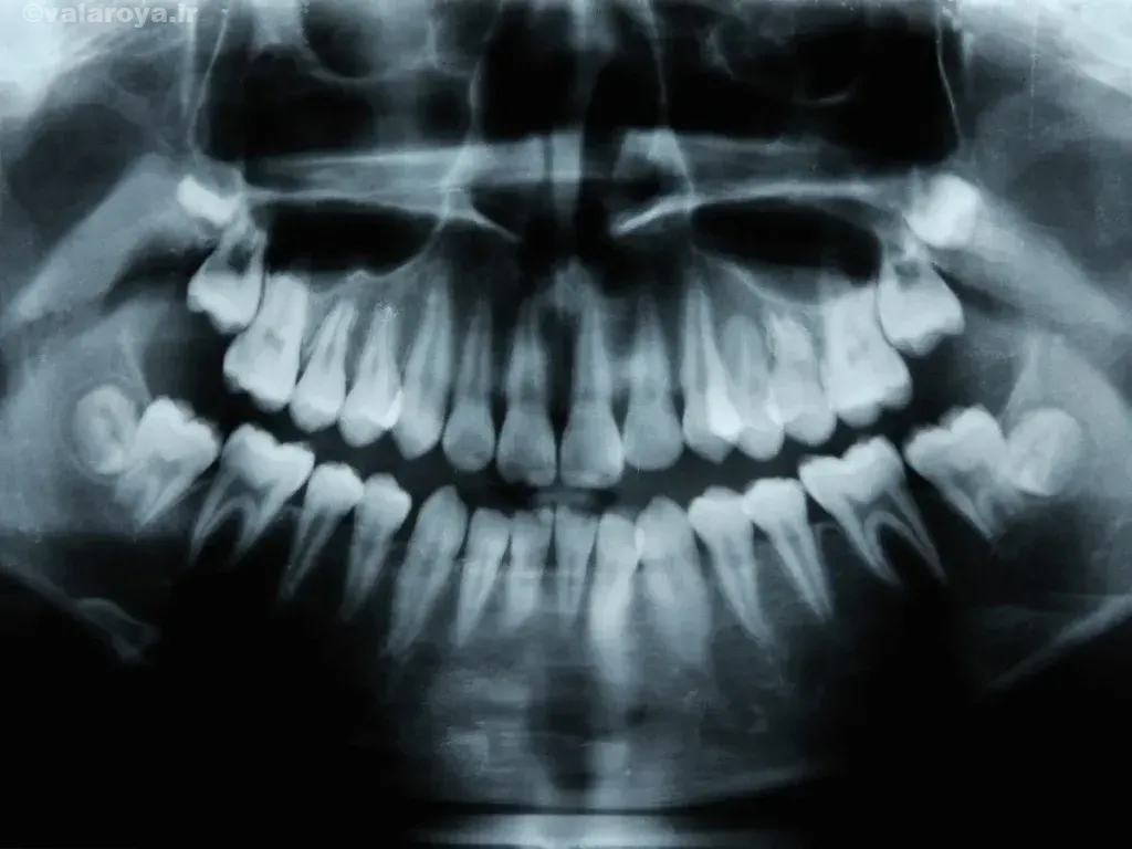 داروی رشد دوباره دندان‌ها 