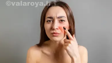 آرایش پوست های حساس