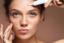 روش‌های خانگی برای درمان مشکلات پوستی رایج مثل آکنه و لکه‌ها