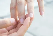 آیا کمبود کلسیم باعث شکستن ناخن می شود؟