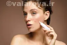 تشخیص انواع جوش های صورت در خانم ها