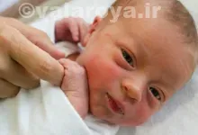 راه های درمان زردی نوزاد