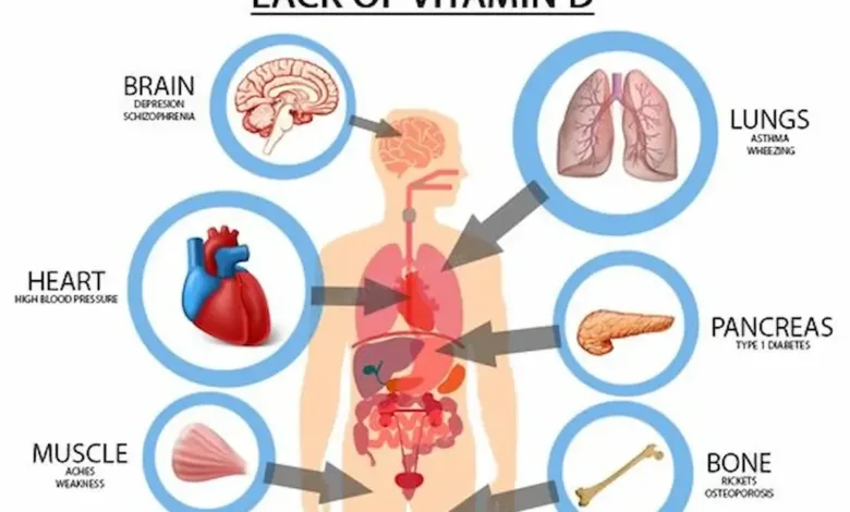 عوارض کمبود ویتامین D چیست؟