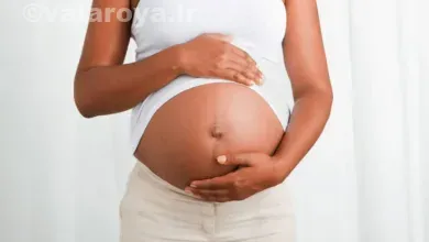 کلاستاز بارداری چیست؟