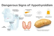 آیا سیب زمینی برای کم کاری تیروئید مضر است