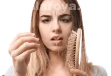 راه های کنترل و پیشگیری در ریزش مو بعد از درمان کراتین