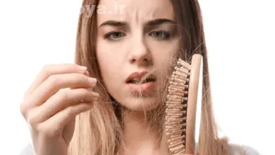 راه های کنترل و پیشگیری در ریزش مو بعد از درمان کراتین