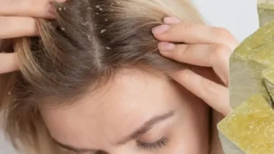 درمان خانگی درمان شپش