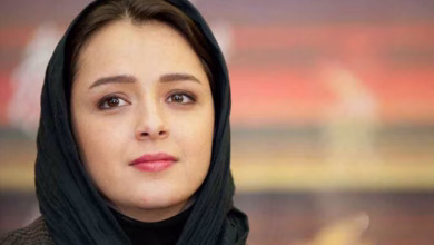 عکس ترانه علیدوستی بعد ابتلا به سندرم درس