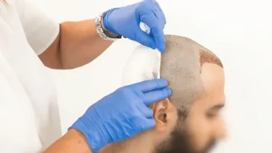 نحوه جلوگیری از عفونت بعد از کاشت مو