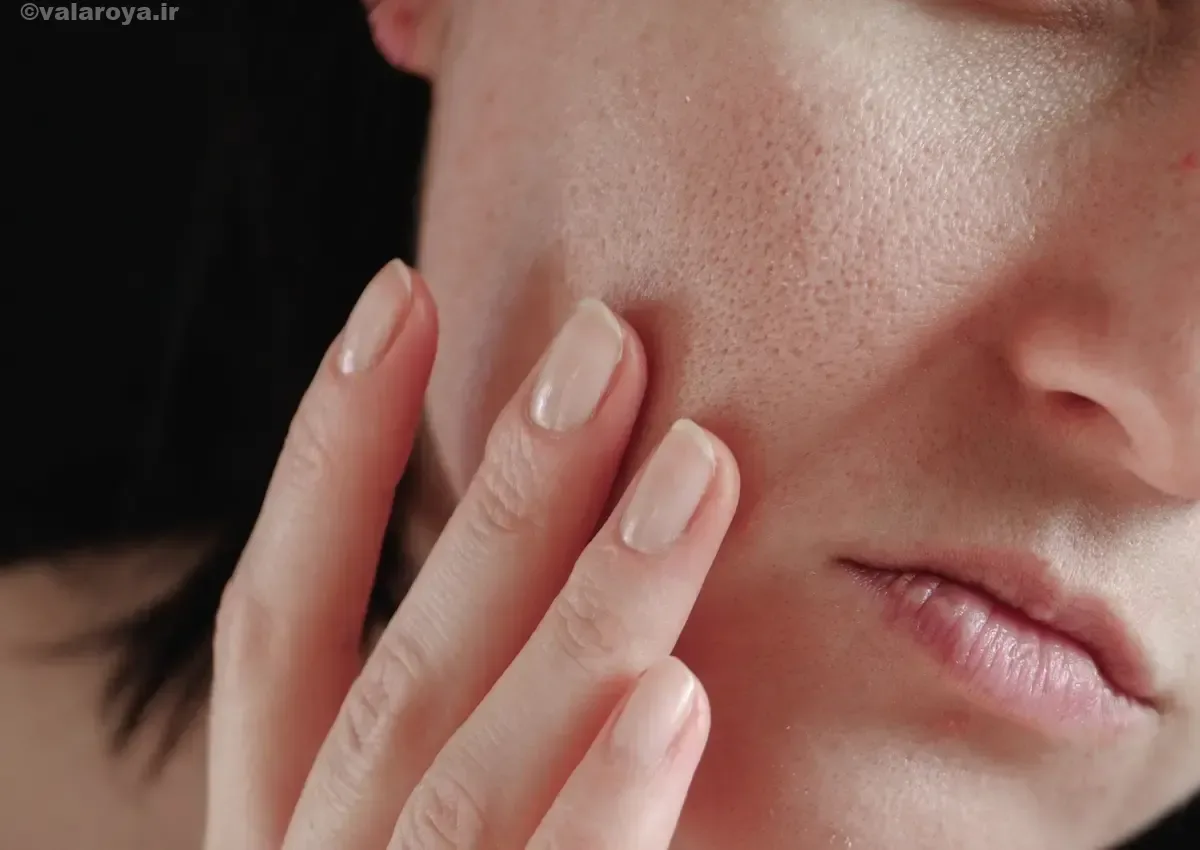 انسداد منافذ پوست