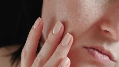 انسداد منافذ پوست