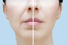 چگونه می‌توانم از آرایش برای پوشاندن چین و چروک‌ها استفاده کنم؟