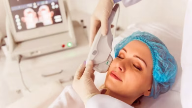 لایه‌برداری شیمیایی صورت