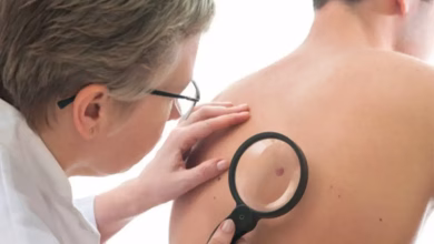 پیشگیری از سرطان پوست