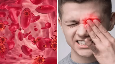 علائم کم خونی