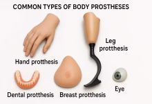 پروتز اندام