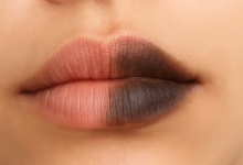 تیره شدن لب ها