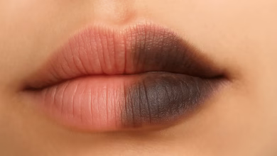 تیره شدن لب ها