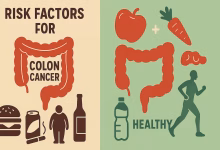 پیشگیری از سرطان روده بزرگ
