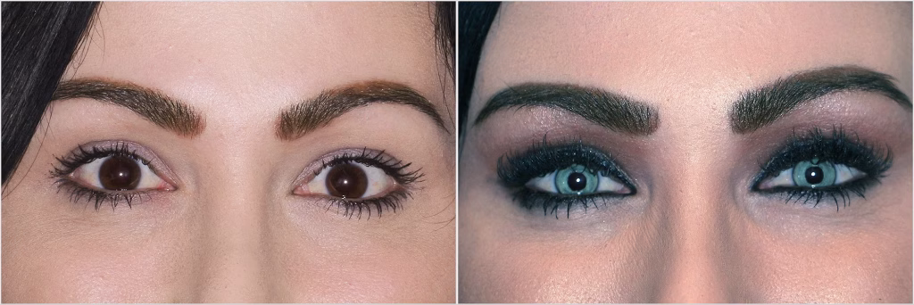 عمل دائمی تغییر رنگ چشم